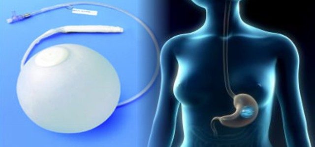 gastric_balloon_image_emax